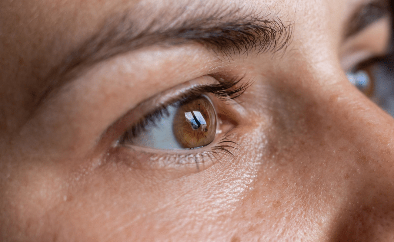 What Is Keratoconus? Early Signs and Treatments You Shouldn’t Ignore