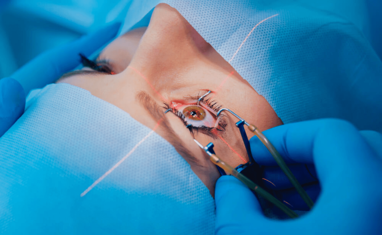 How Long Does Cataract Surgery Take? Full Timeline Explained
